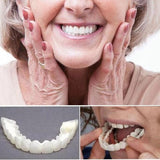 Instant Smile Veneers (Upper & Lower Set)