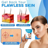 Skin Tag Removal Kit – Ligation Bands, Applicator Tool & No-Cut Method