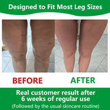 BowLift | Sakerplus Cellulite Massage Roller