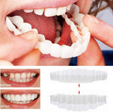 BowLift | On Smile Veneers (Upper and Lower Jaw included)