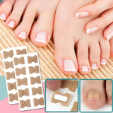 Ingrown Toenail Correction Patches – Painless Lifting, Discreet & Skin-Friendly