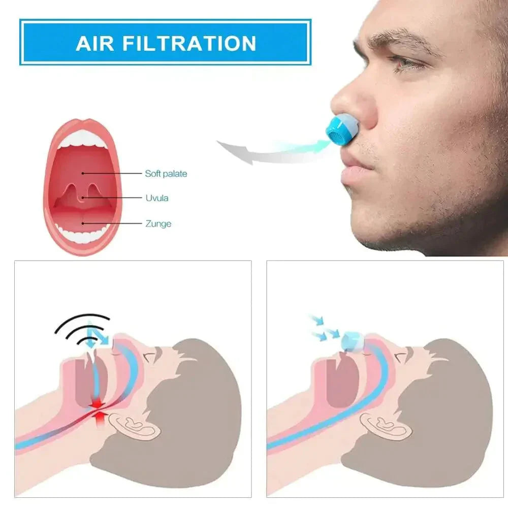 Micro CPAP Sleep Apnea Machine – Portable, Rechargeable & Anti-Snoring Design