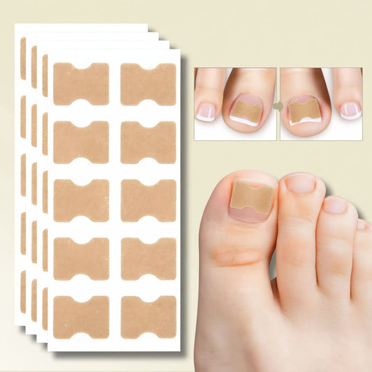 Toenail Corrector Patches – Ingrown Nail Treatment
