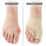 Bunion Corrector Toe Sleeves – Unisex, Gel Cushion, Breathable, 2 Pairs