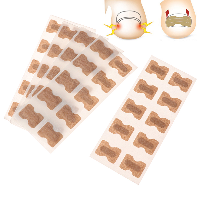 Ingrown Toenail Correction Patches – Painless Lifting, Discreet & Skin-Friendly