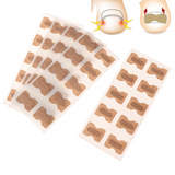 Ingrown Toenail Correction Patches – Painless Lifting, Discreet & Skin-Friendly