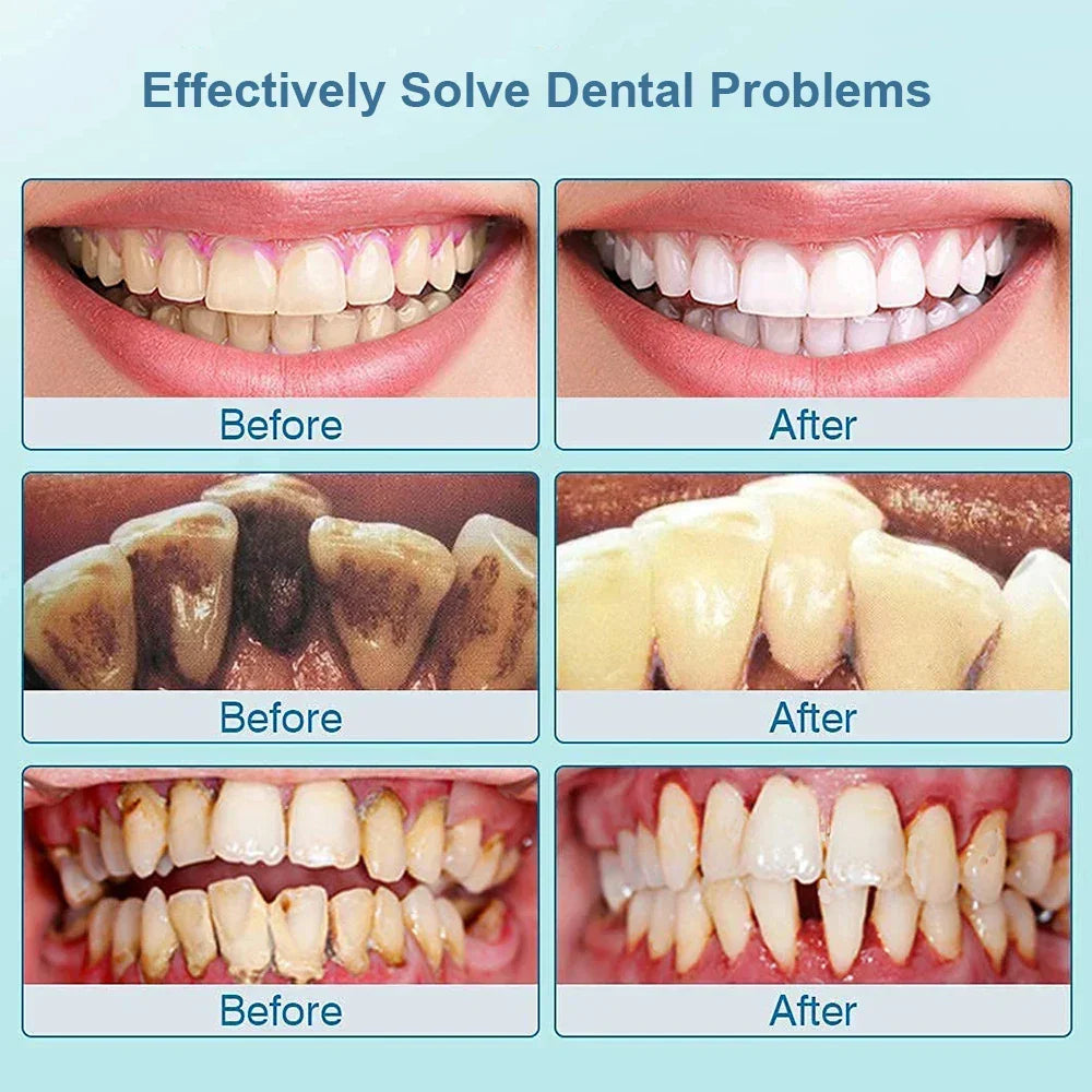 Ultrasonic Toothbrush - SonicClean