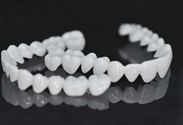 BowLift | DentAlign Dental Veneers – Natural Fit and Comfort