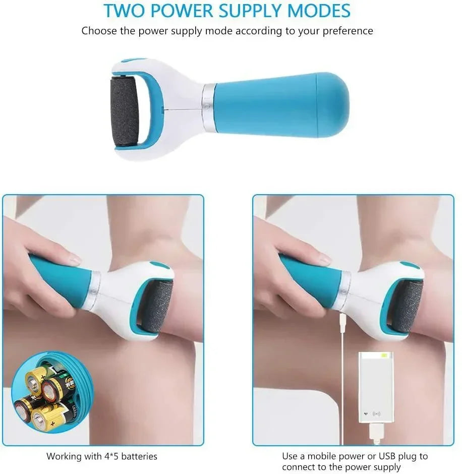 Electric Callus Remover – Battery-Operated, Replaceable Grinding Heads & Washable