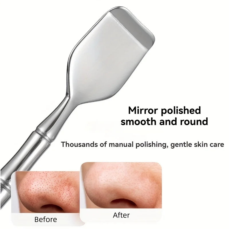 Blackhead Remover Set – Double-Sided Stainless Steel, Polished & Ergonomic Grip