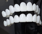 Kalsten | Customizable Dental Prosthesis with Dental Lenses