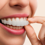 Teeth Veneer Cosmetic Cover Set Smile Enhancement