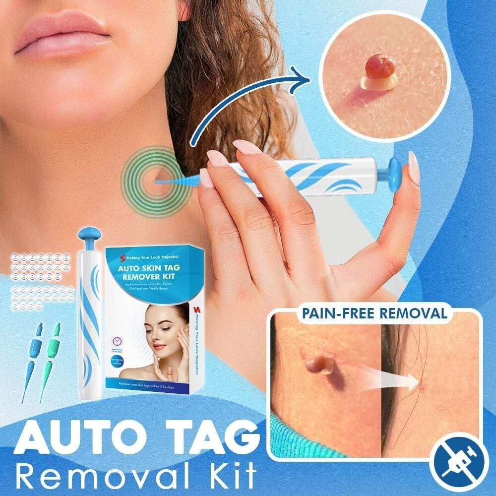 Skin Tag Removal Kit – Ligation Bands, Applicator Tool & No-Cut Method