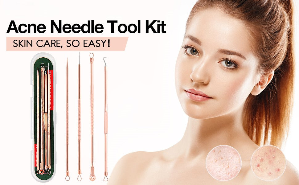 Professional Blackhead & Pimple Extractor Kit - Stainless Steel Acne Removal Tools for Clear Skin