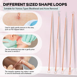 Professional Blackhead & Pimple Extractor Kit - Stainless Steel Acne Removal Tools for Clear Skin