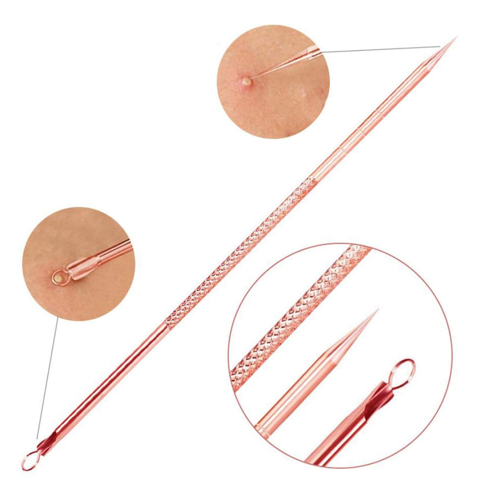 Professional Blackhead & Pimple Extractor Kit - Stainless Steel Acne Removal Tools for Clear Skin