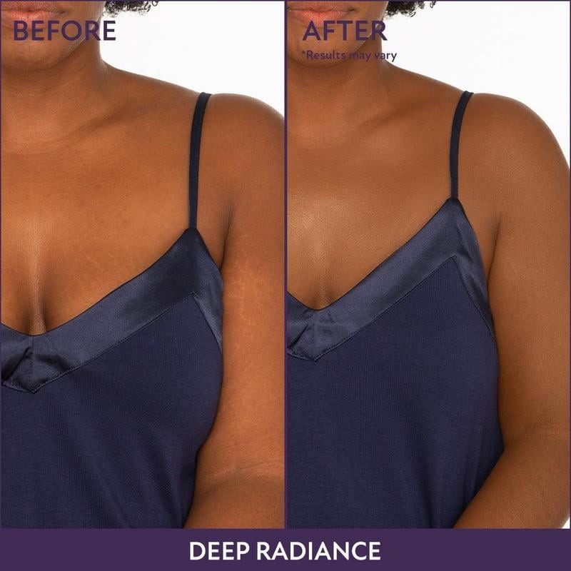 Flawless Body Skin Perfector - Achieve Smooth, Radiant Skin with Our Advanced Body Treatment
