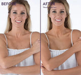 Flawless Body Skin Perfector - Achieve Smooth, Radiant Skin with Our Advanced Body Treatment