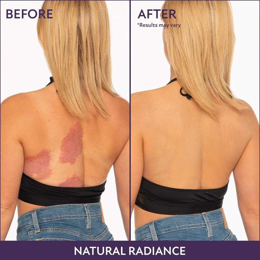 Flawless Body Skin Perfector - Achieve Smooth, Radiant Skin with Our Advanced Body Treatment