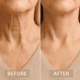 Kalsten | Neck Lifting Tape | Instant Firming & Sculpting Effect | Invisible & Skin-Safe Adhesive