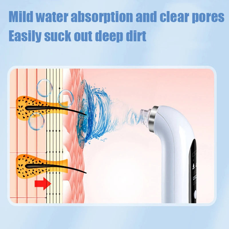 Enhanced Product Title: Davy Professional Blackhead Remover Vacuum - Deep Cleansing Suction Technology for Flawless Skin 

This title includes keywords that are likely to attract more clicks while clearly conveying the product's purpose and benefits.
