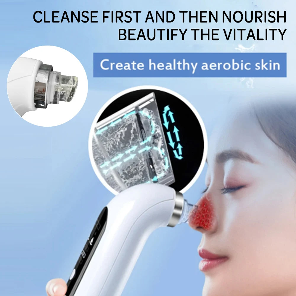 Enhanced Product Title: Davy Professional Blackhead Remover Vacuum - Deep Cleansing Suction Technology for Flawless Skin 

This title includes keywords that are likely to attract more clicks while clearly conveying the product's purpose and benefits.