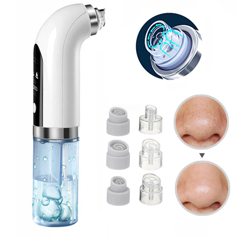 Enhanced Product Title: Davy Professional Blackhead Remover Vacuum - Deep Cleansing Suction Technology for Flawless Skin 

This title includes keywords that are likely to attract more clicks while clearly conveying the product's purpose and benefits.