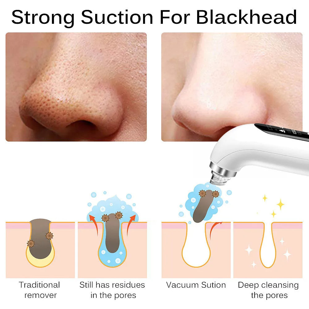 Enhanced Product Title: Davy Professional Blackhead Remover Vacuum - Deep Cleansing Suction Technology for Flawless Skin 

This title includes keywords that are likely to attract more clicks while clearly conveying the product's purpose and benefits.