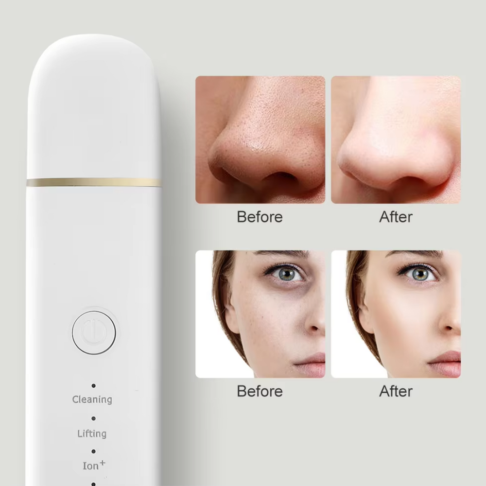 Professional Deep Cleansing Skin Scrubber - Exfoliating Facial Tool for Clear, Radiant Skin