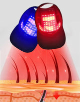 HairGlow Pro – Infrared Red Light Therapy Cap
