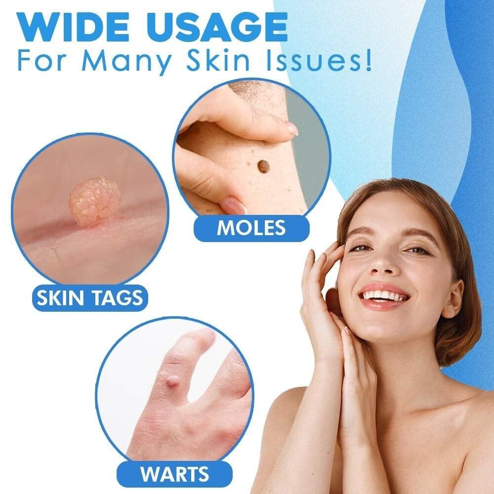 Skin Tag Removal Kit – Ligation Bands, Applicator Tool & No-Cut Method