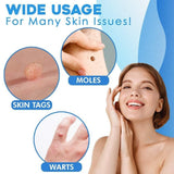 Skin Tag Removal Kit – Ligation Bands, Applicator Tool & No-Cut Method