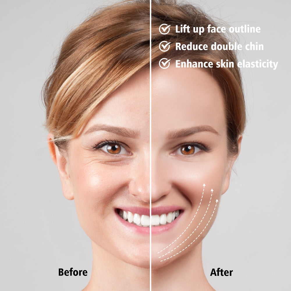 EMS Face Lift Device with LED Therapy - Slimming Facial Treatment & Double Chin Reduction