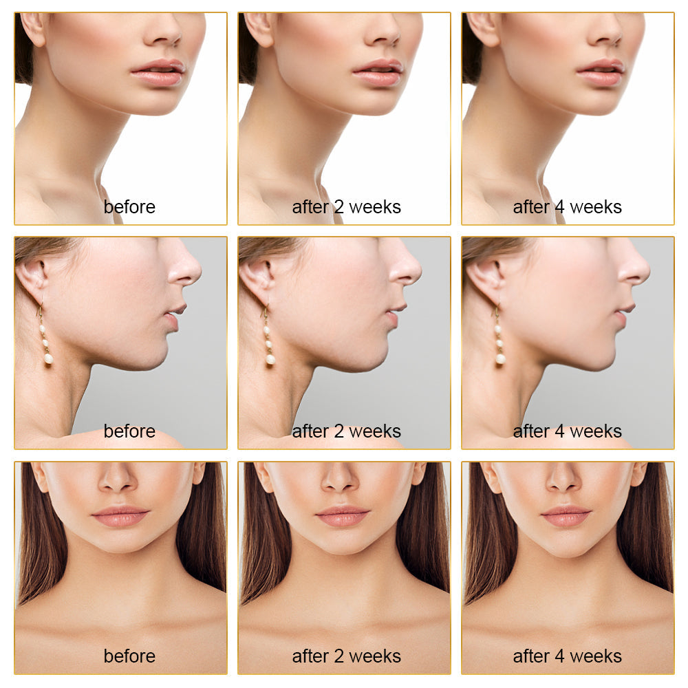EMS Face Lift Device with LED Therapy - Slimming Facial Treatment & Double Chin Reduction