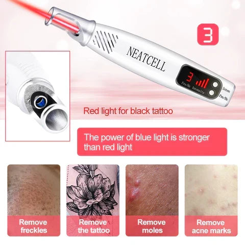 Advanced Picosecond Laser Eraser Pen for Flawless Skin - Remove Imperfections, Scars & Pigmentation