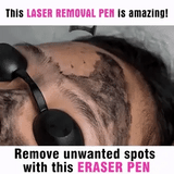 Advanced Picosecond Laser Eraser Pen for Flawless Skin - Remove Imperfections, Scars & Pigmentation