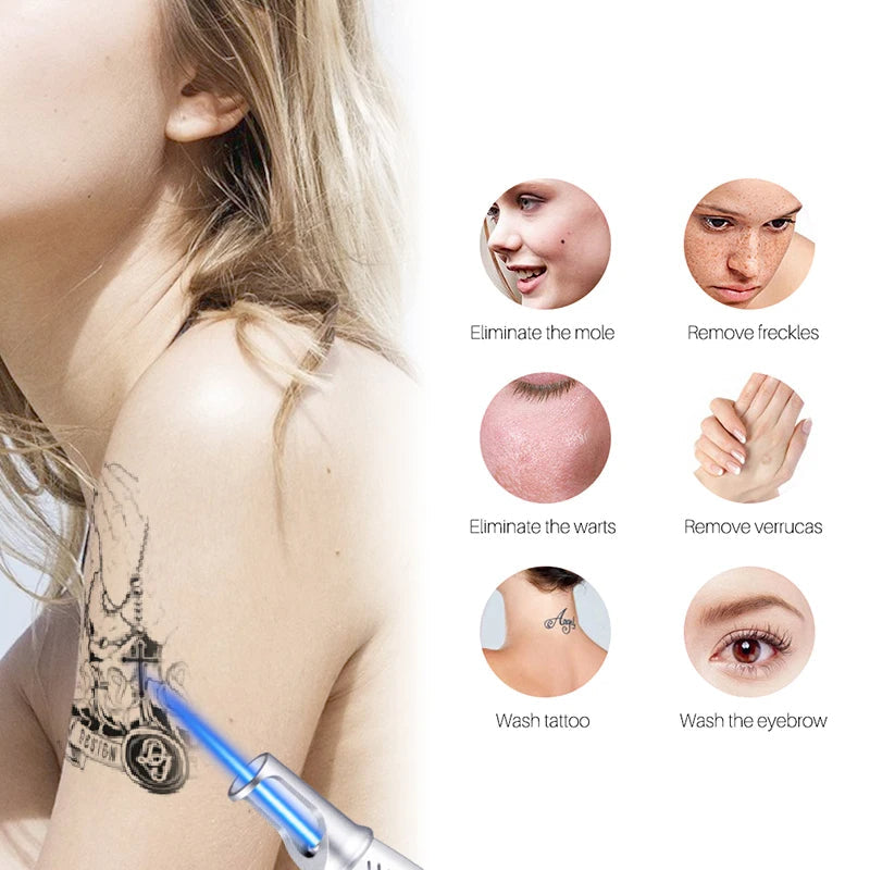 Advanced Picosecond Laser Eraser Pen for Flawless Skin - Remove Imperfections, Scars & Pigmentation