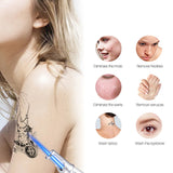 Advanced Picosecond Laser Eraser Pen for Flawless Skin - Remove Imperfections, Scars & Pigmentation