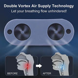 Portable Anti-Snoring Device | Sleep Apnea Relief & Comfortable Sleep Aid