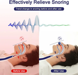 Portable Anti-Snoring Device | Sleep Apnea Relief & Comfortable Sleep Aid