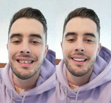 NovaBright Instant Smile Cosmetic Teeth Covers - Effortless Smile Transformation & Confidence Boost