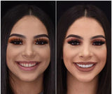 NovaBright Instant Smile Cosmetic Teeth Covers - Effortless Smile Transformation & Confidence Boost