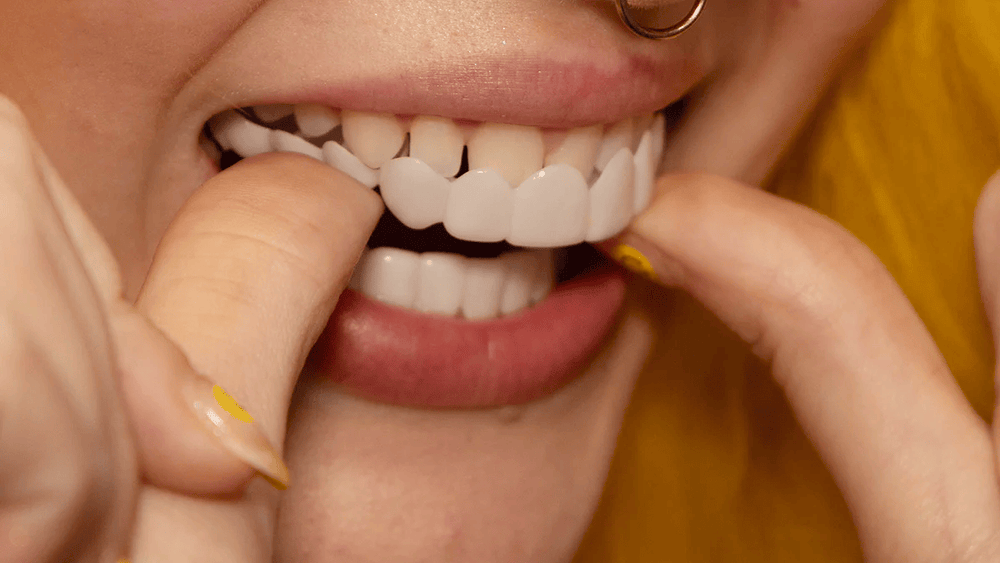NovaBright Instant Smile Cosmetic Teeth Covers - Effortless Smile Transformation & Confidence Boost