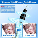 Enhanced Product Title: **Ultrasonic Pet Tartar Remover - Professional Tooth Cleaner for Dogs and Cats | Safe, Effective Dental Care Tool**