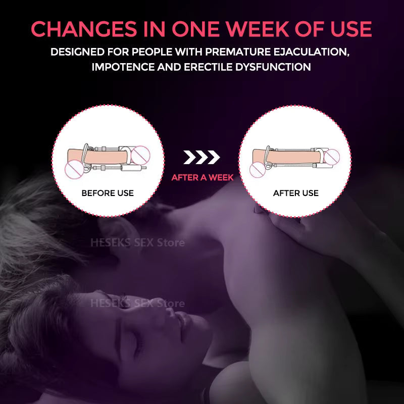 Men's Growth Stretcher for Enhanced Size & Firmness - Adjustable Comfort Design