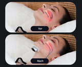 AirEase Sleep Apnea Device - Comfortable CPAP Alternative for Better Sleep & Breathing Support